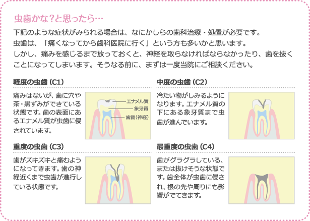 虫歯かな？と思ったら…